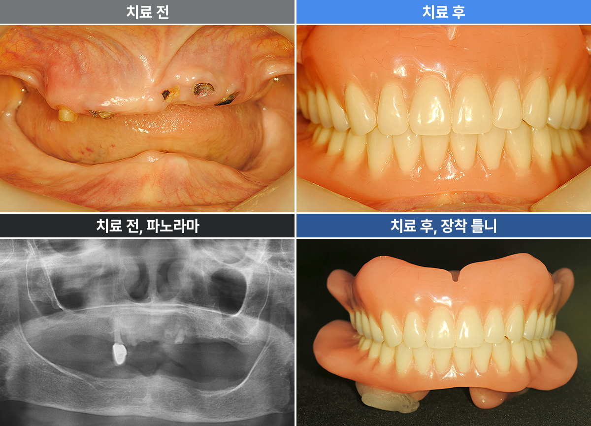 임길례