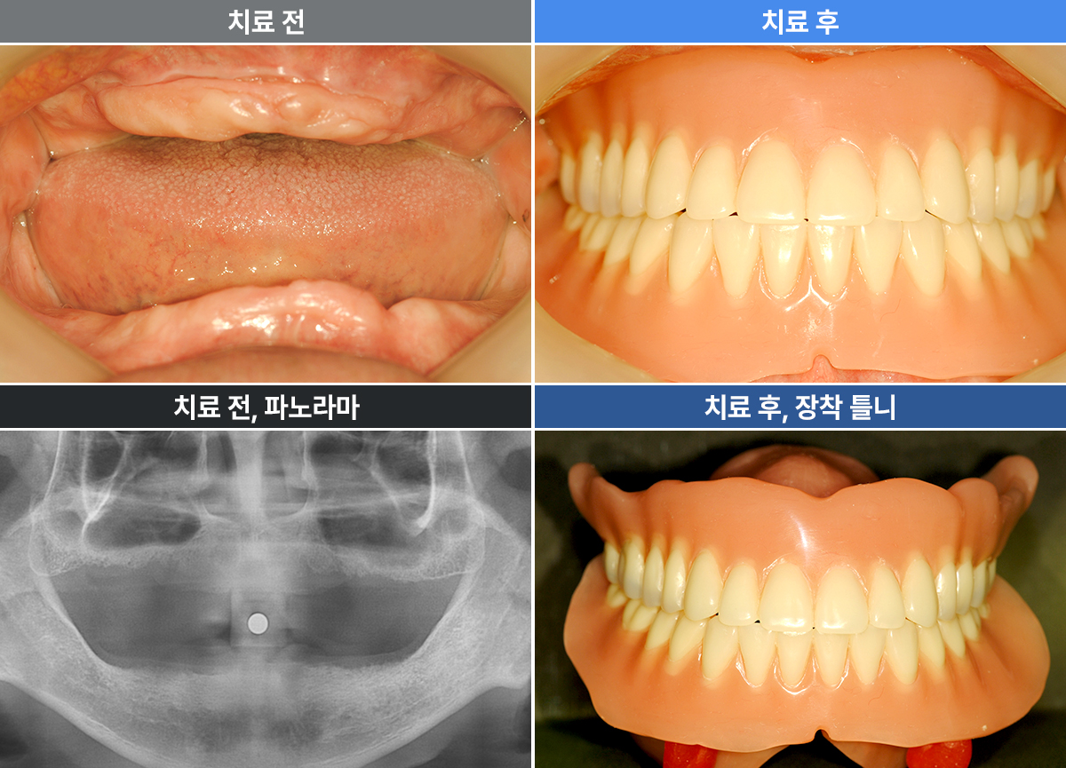 김광식