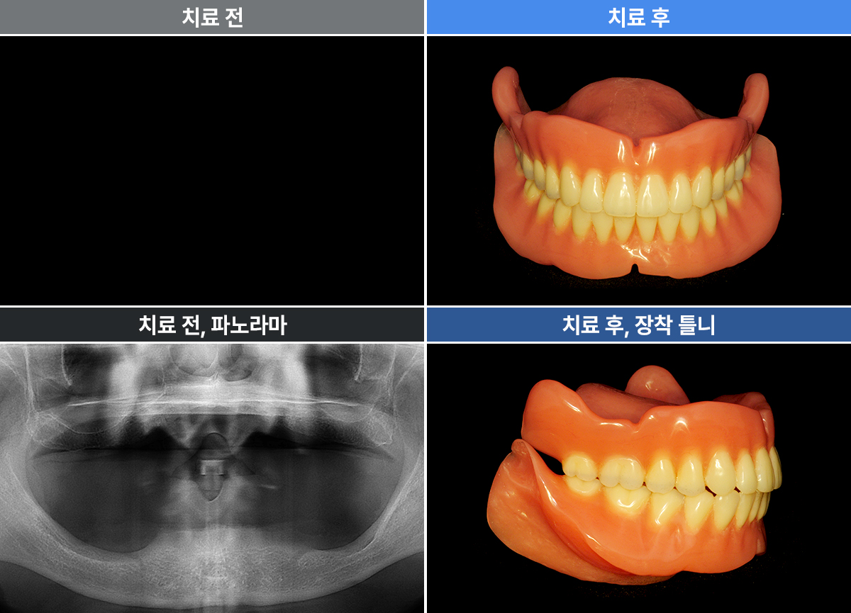 문선순