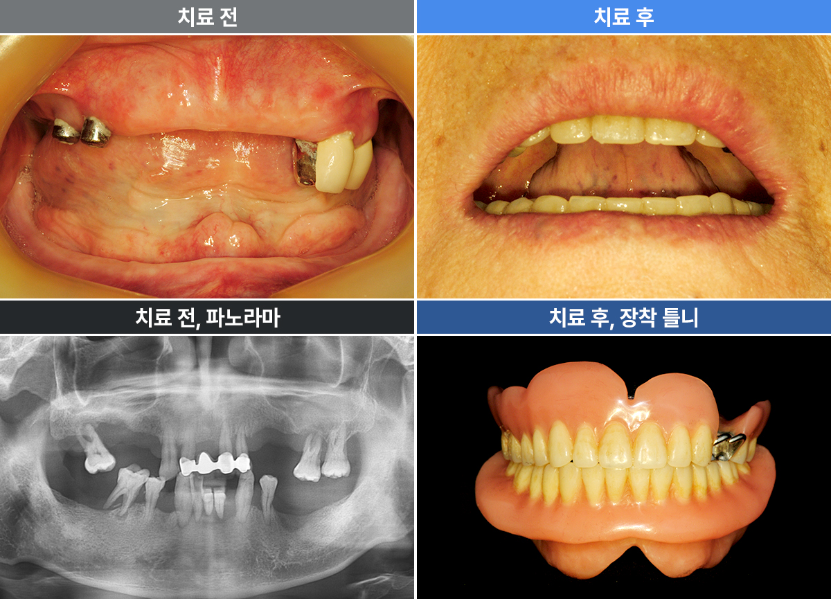 방인채
