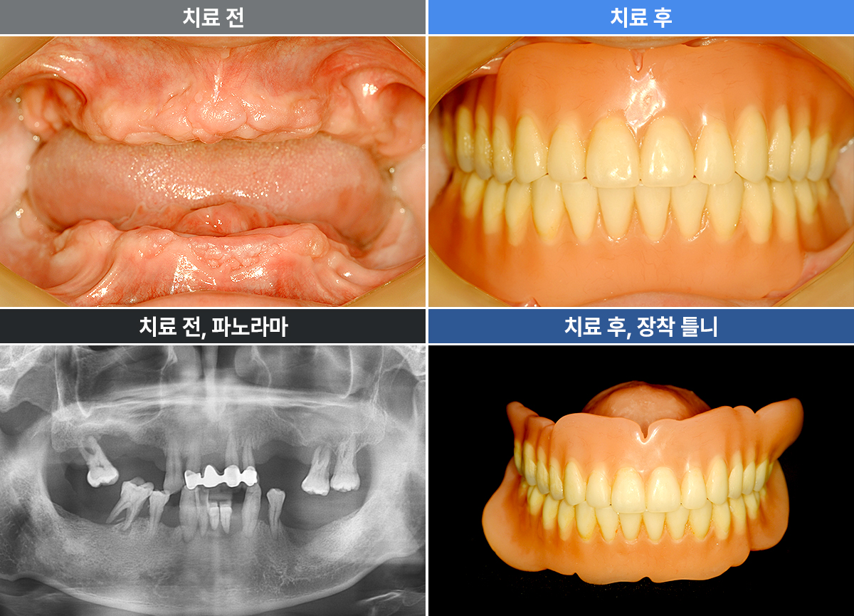 방인채