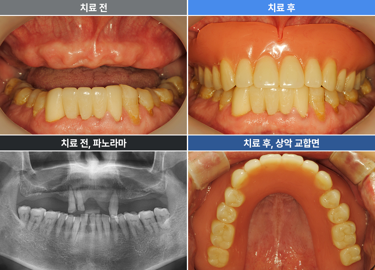 이강백