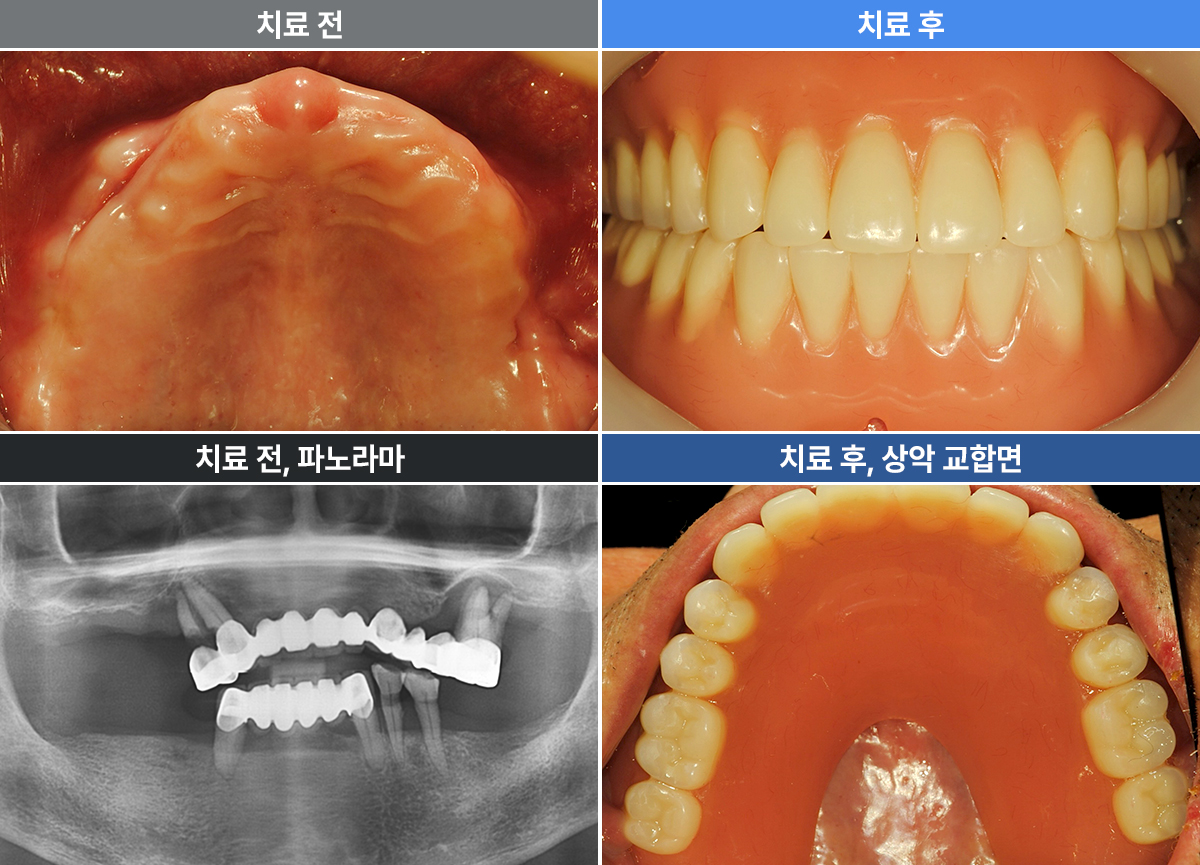 이성철