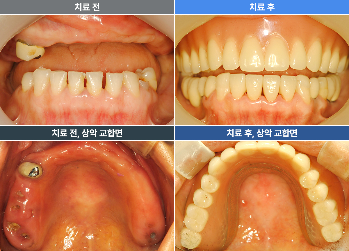 최서진