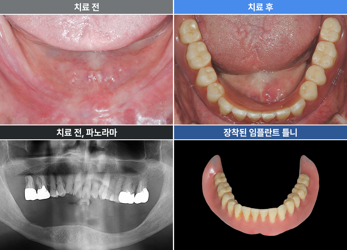 정재윤