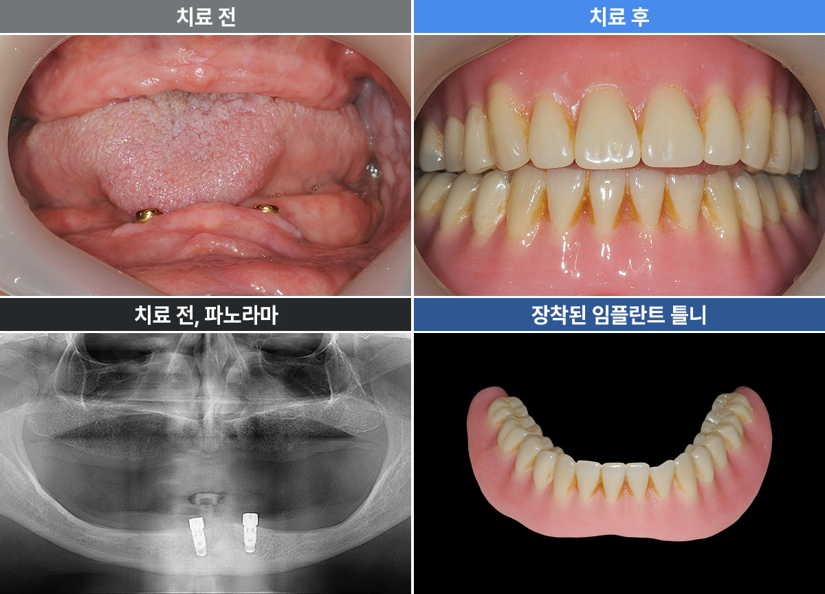 정재오