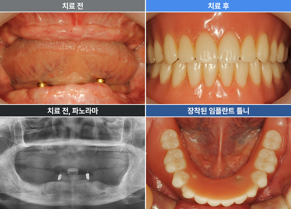 전국희
