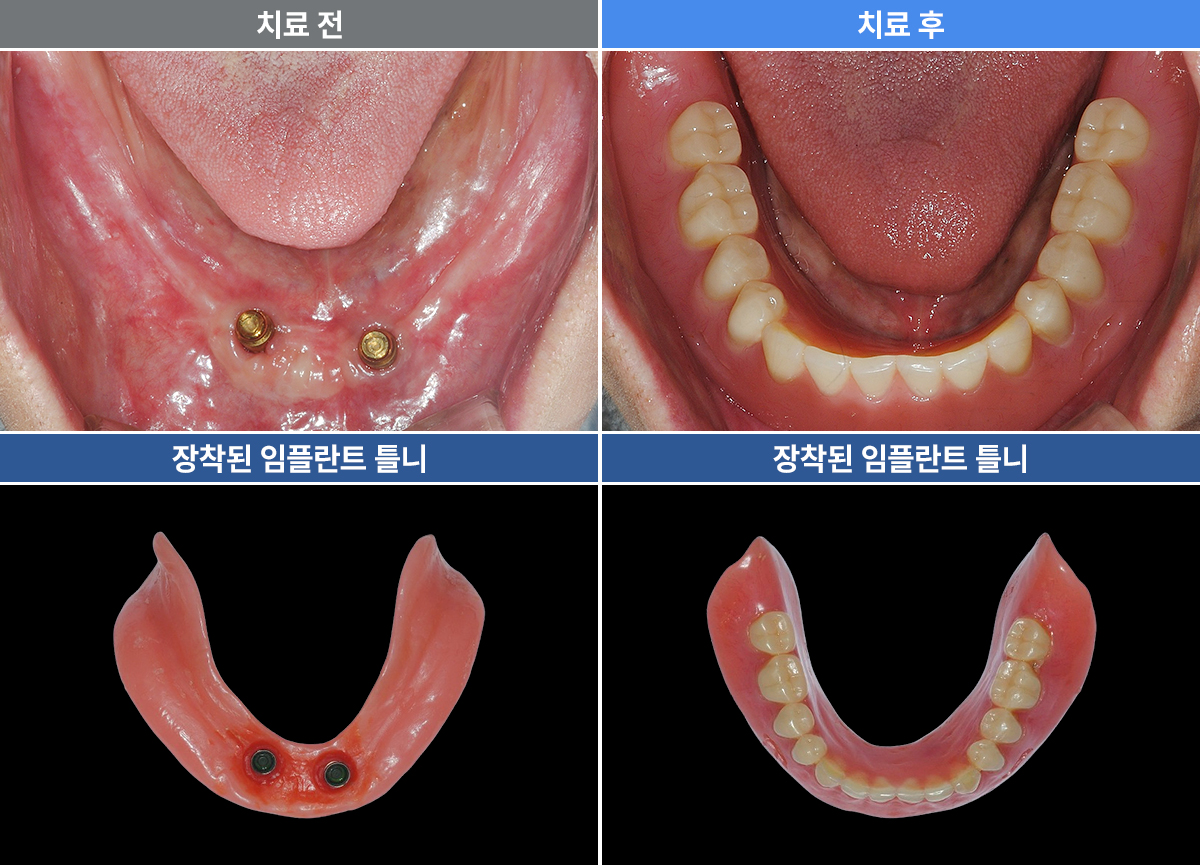 장순금