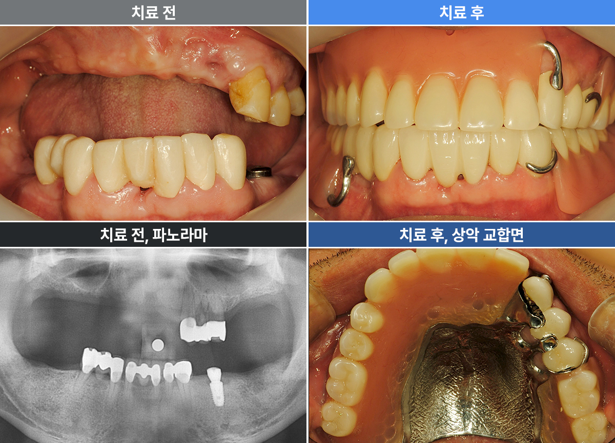 김대웅
