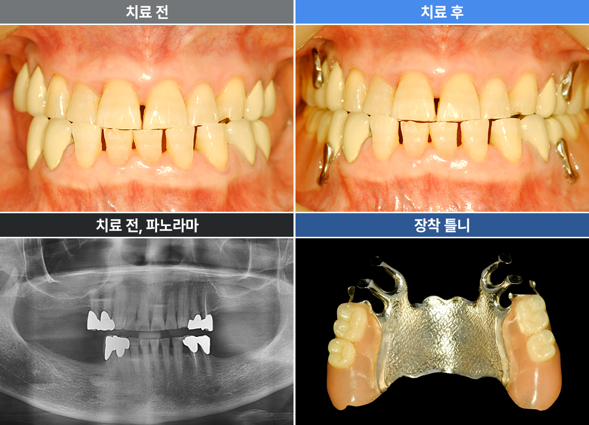 정명선