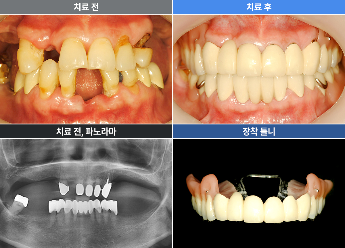 최윤진