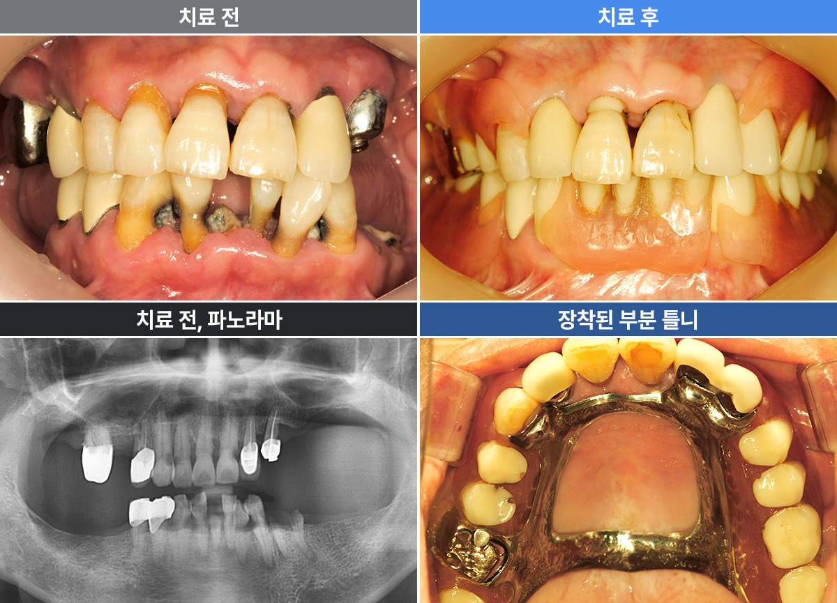 김형찬