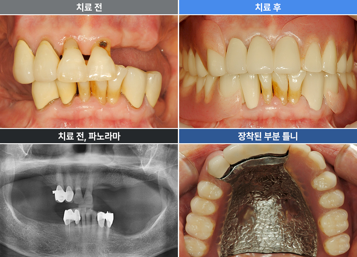 조계순