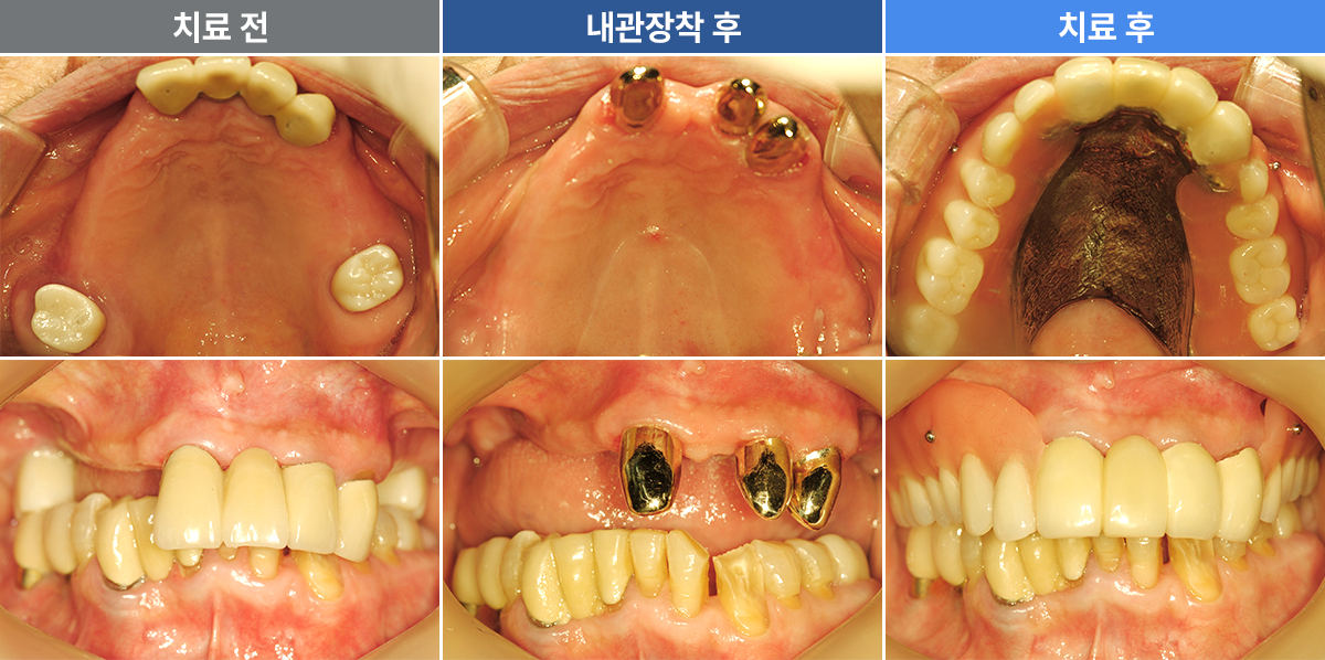 이득선