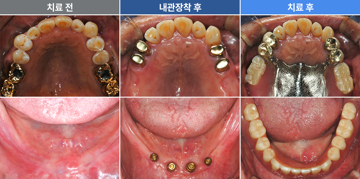 정재윤