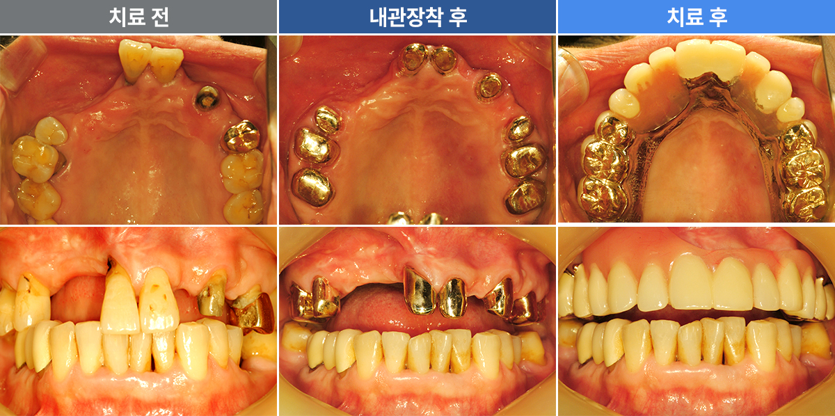 김인덕