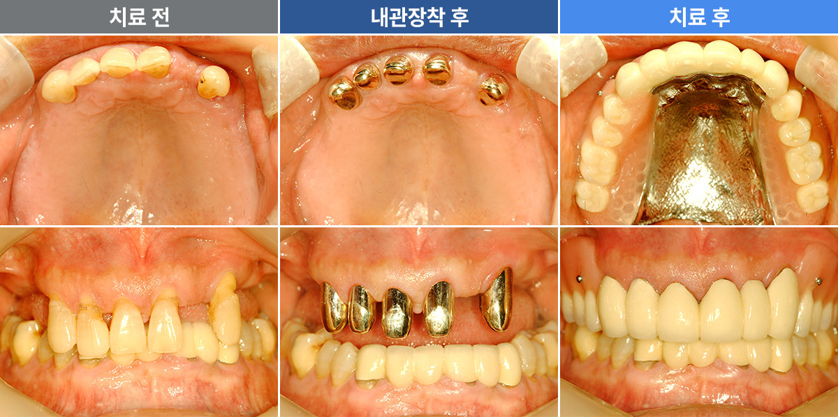 김해수
