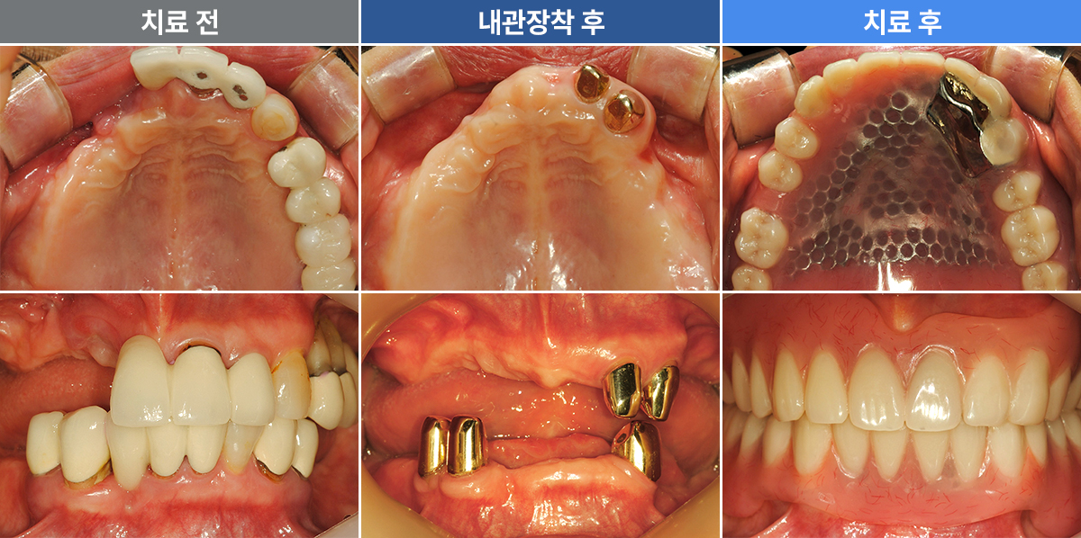 오진희