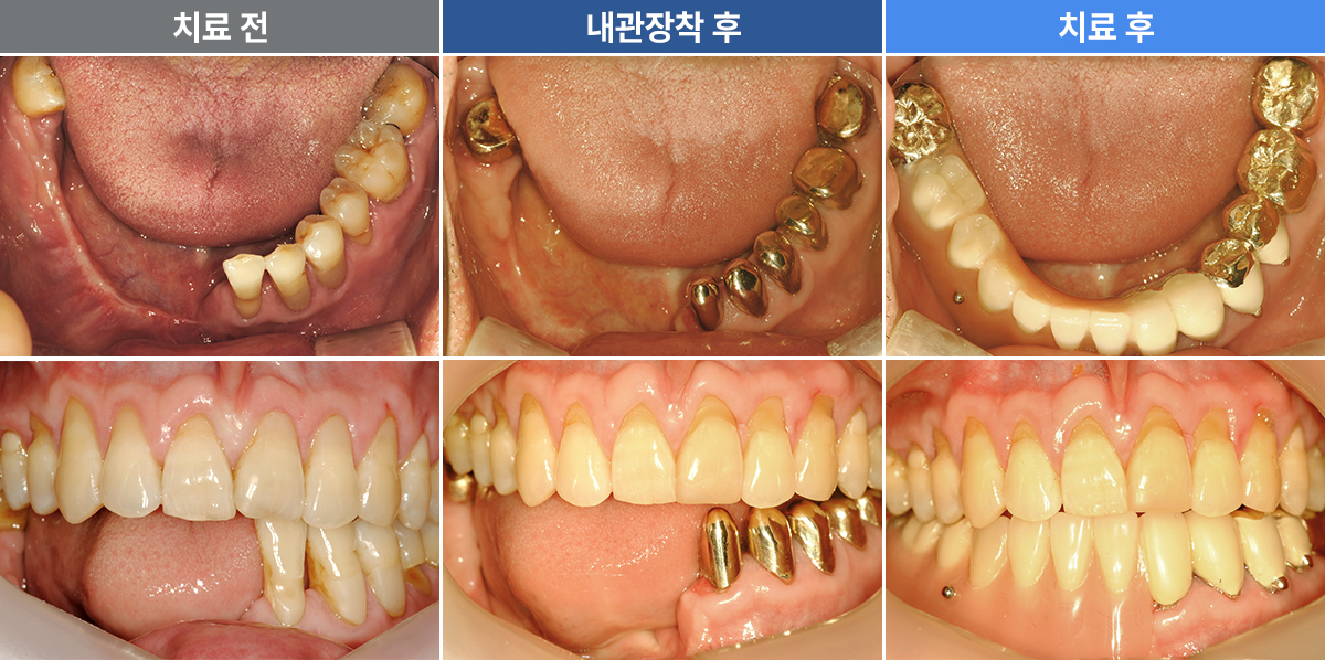 유복남