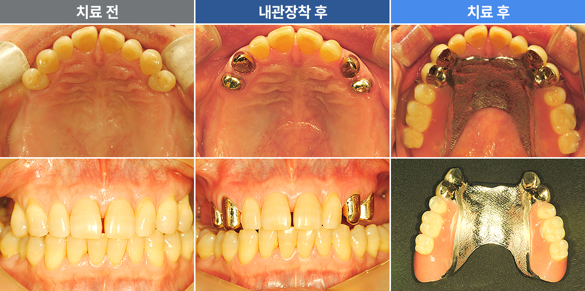 전재형