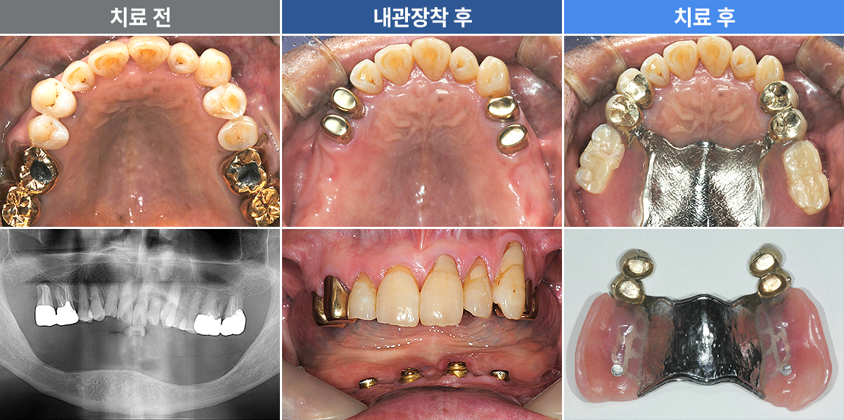 정재윤