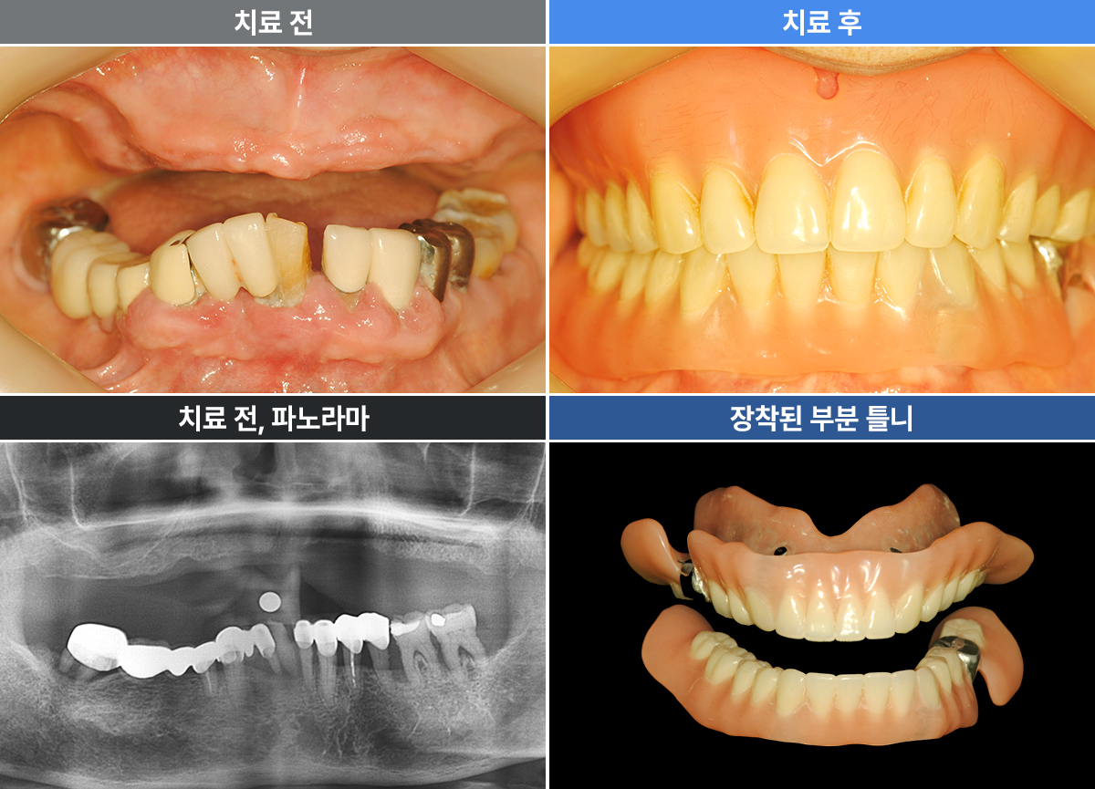 최미자