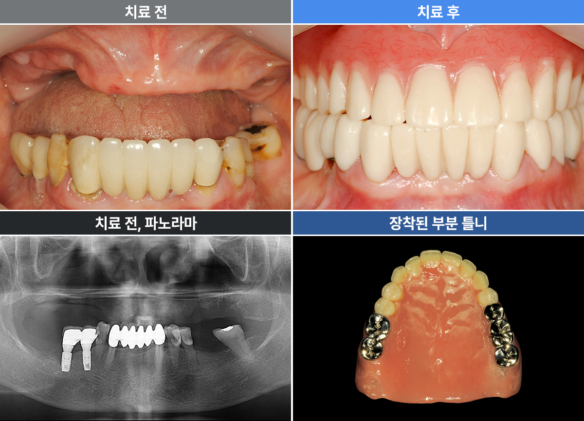 이병선