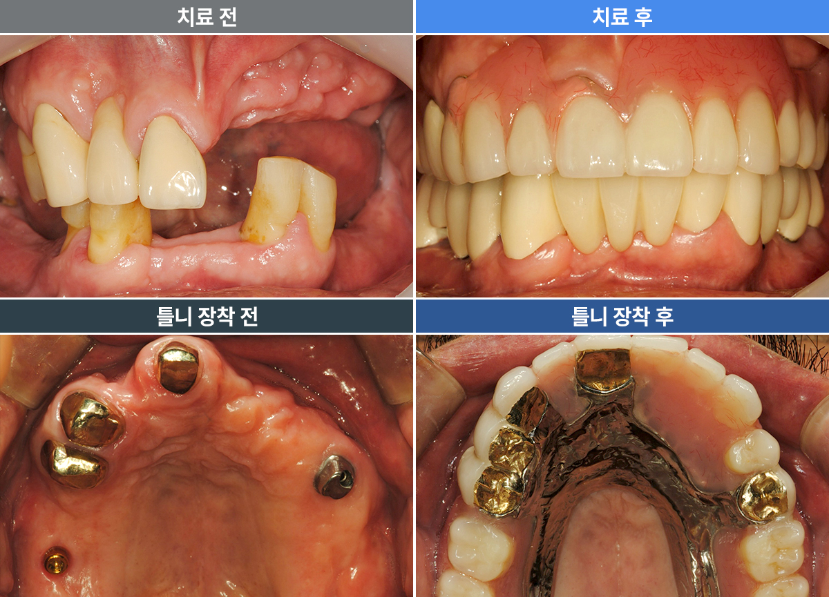 알렉산더
